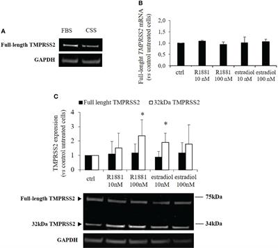 TMPRSS2 Expression and Activity Modulation by Sex-Related Hormones in Lung Calu-3 Cells: Impact on Gender-Specific SARS-CoV-2 Infection